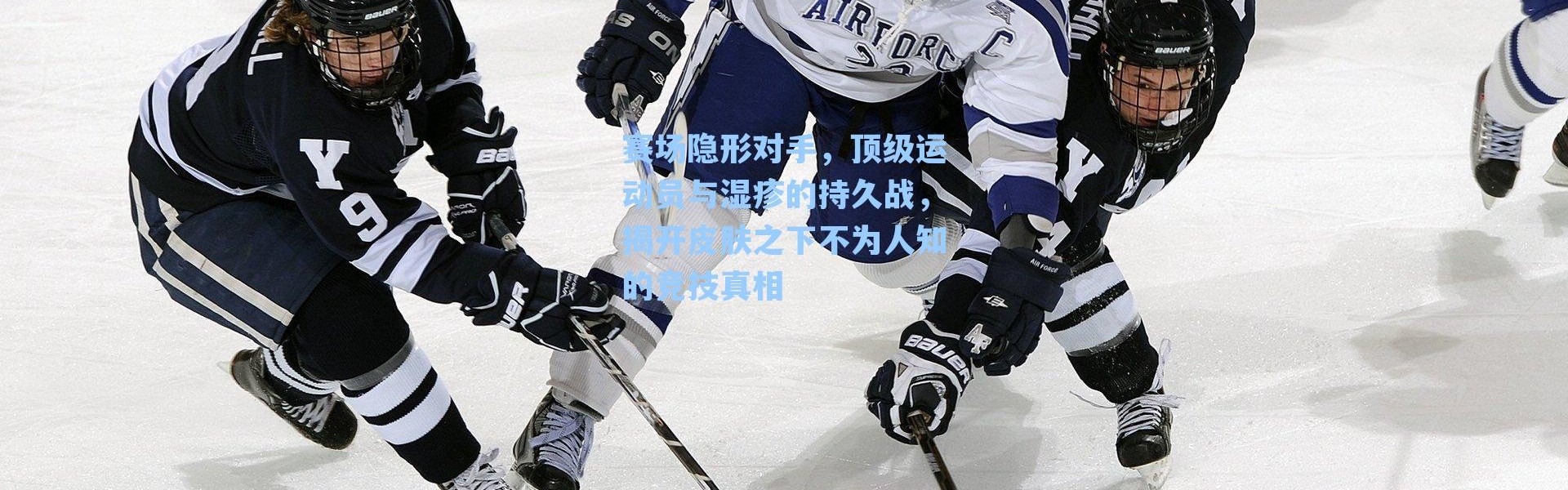 赛场隐形对手，顶级运动员与湿疹的持久战，揭开皮肤之下不为人知的竞技真相