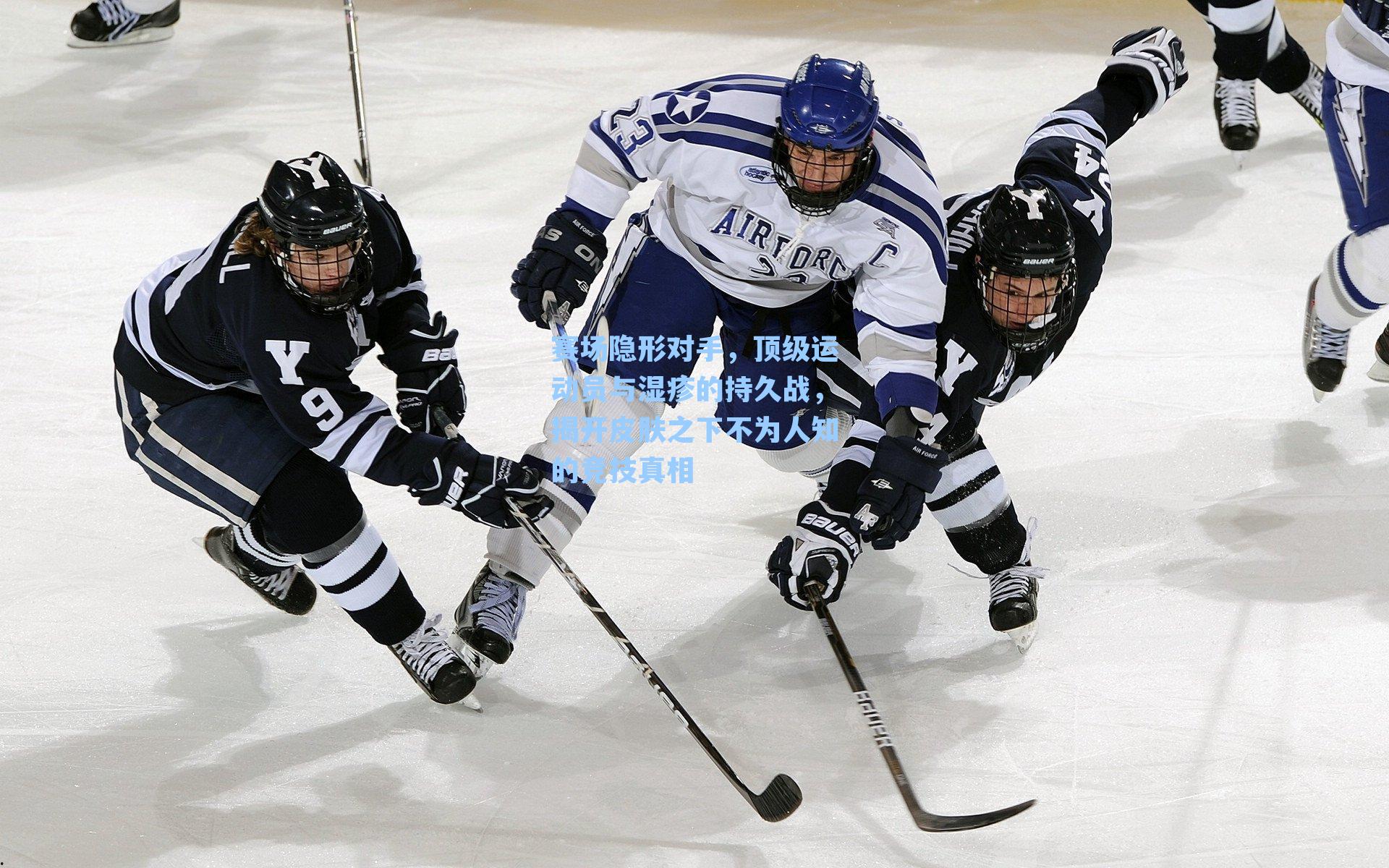 赛场隐形对手,顶级运动员与湿疹的持久战,揭开皮肤之下不为人知的竞技真相
